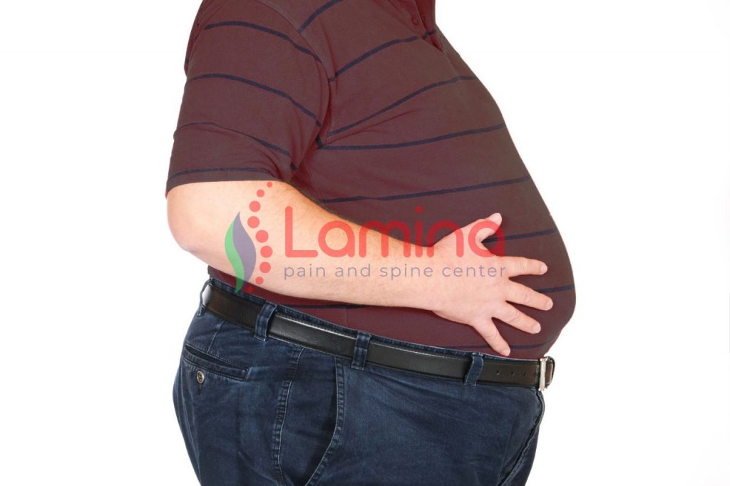 Kegemukan picu lutut bengkak dan nyeri