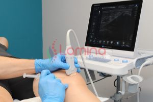 viscosuplemen untuk sakit lutut