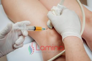 nyeri lutut tanpa operasi