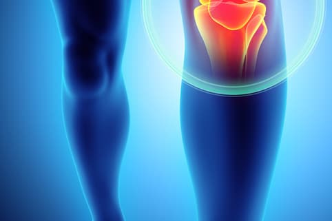 Sakit Belakang Lutut jangan disepelakan