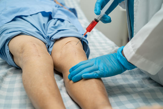 injeksi intra artikular